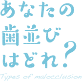 あなたの歯並びはどれ？ Types of malocclusion